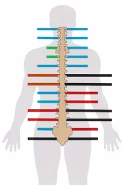Human silhouette with spine overlay and colored horizontal lines marking different spinal levels