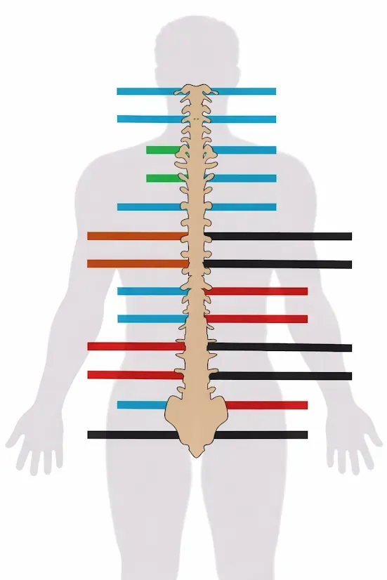 Human silhouette with spine overlay and colored horizontal lines marking different spinal levels