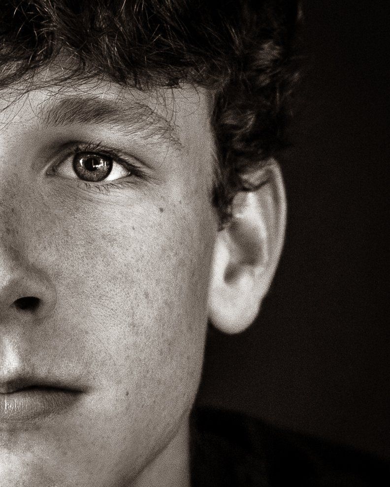 A black and white photo of a young man 's face with freckles.