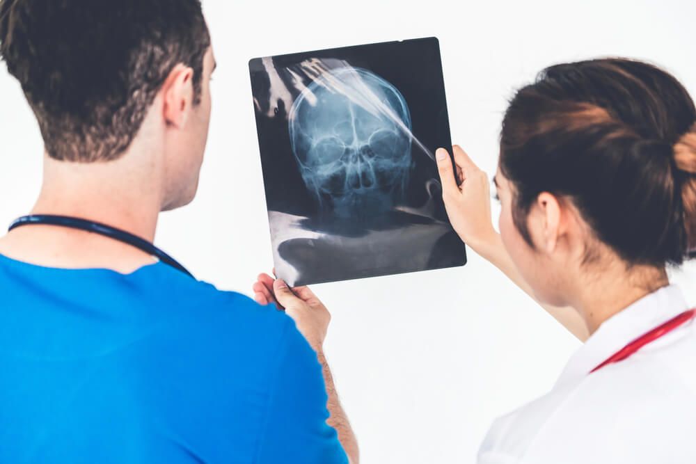What is secondary impact syndrome?