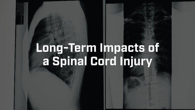 X-ray scans of a human spine with the text 