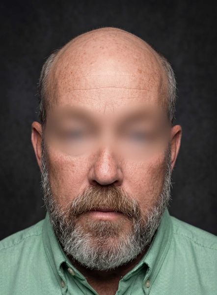 Close-up portrait of a bald man with a beard against a dark background, wearing a green shirt.