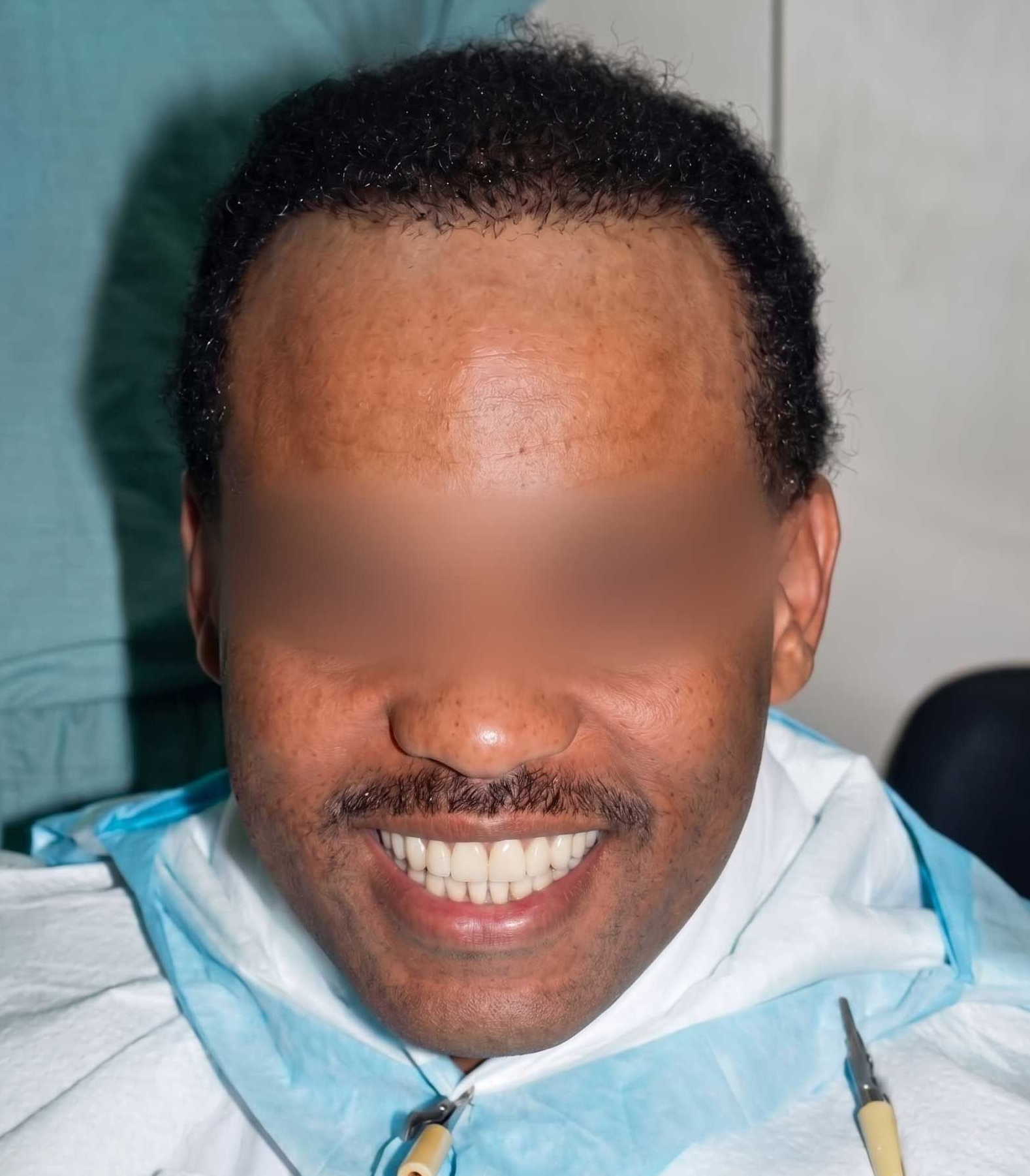 Portrait of a smiling person in a white dental bib and blue mask, with eyes blurred out