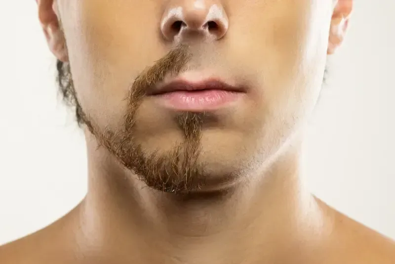 A person's lower face with a partial beard groomed into a single, thick vertical strip on the right side of the chin.