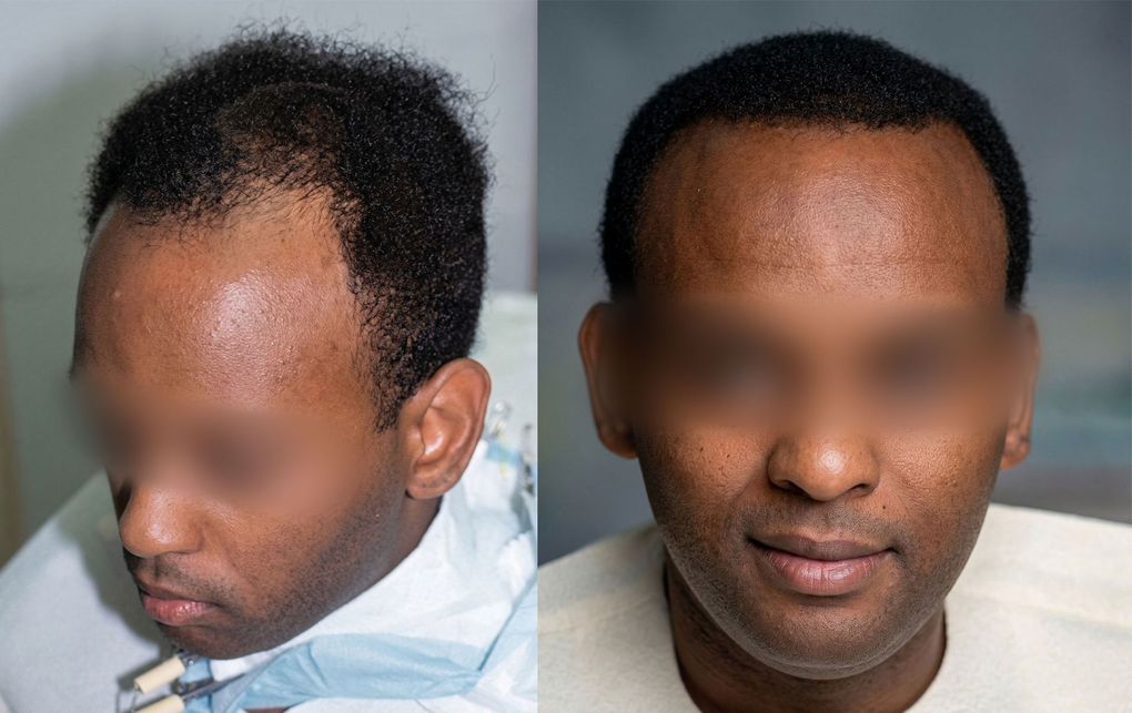 Two portrait photos side by side of the same man, one in profile and one facing forward.