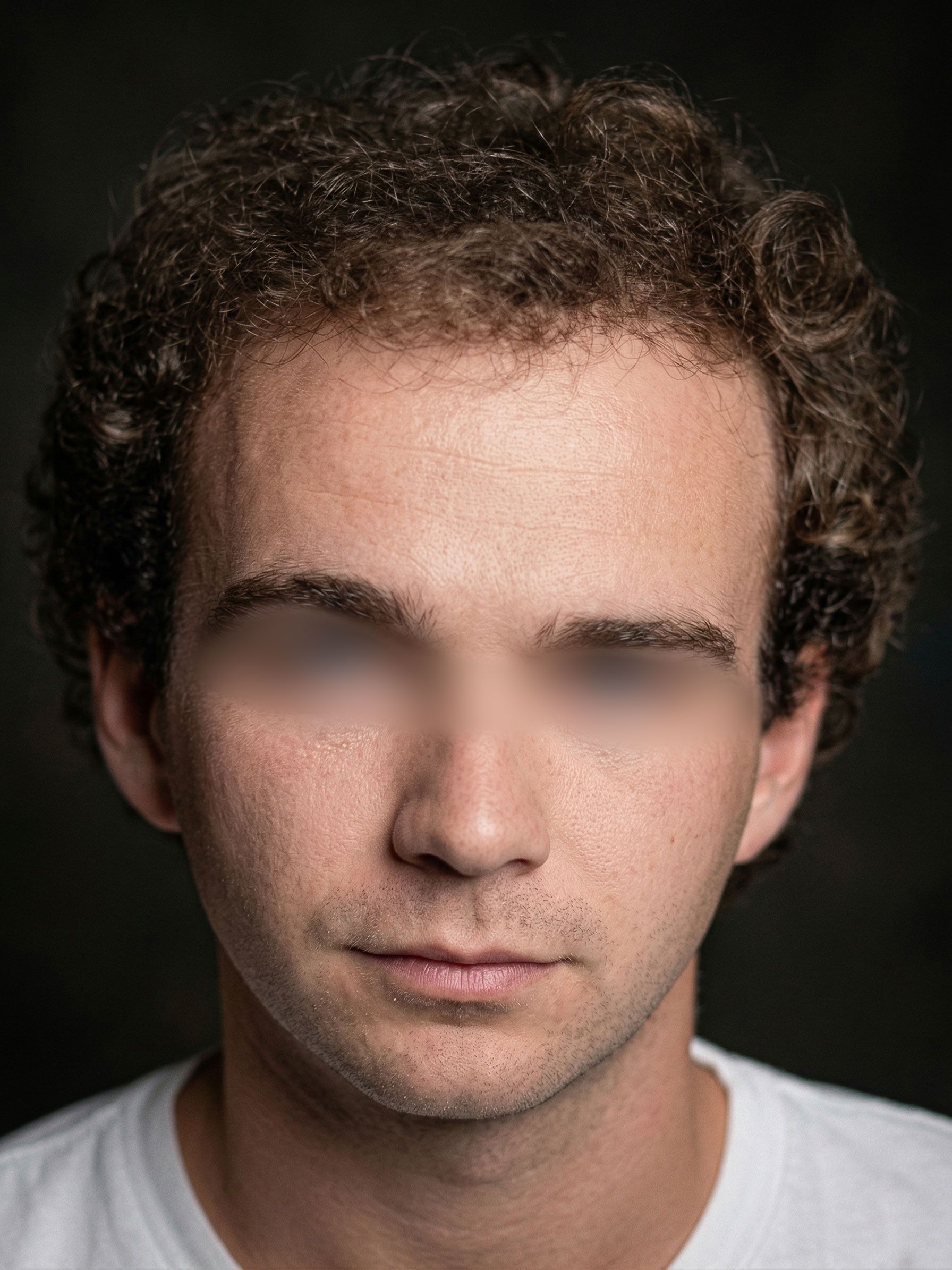 Close-up portrait of a person against a dark background, with blurred eyes and a neutral expression