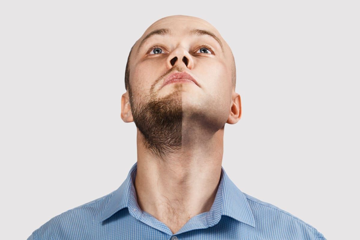 A person looks upward, showing a sharp contrast between a beard on one side of their face and clean-shaven skin on the other.