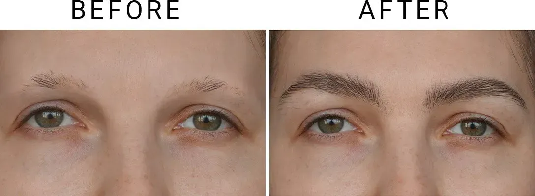Before and after comparison showing fuller, more defined eyebrows after a cosmetic treatment.