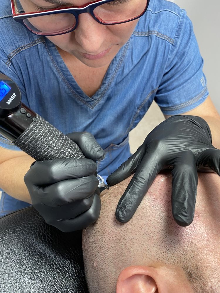 A practitioner in blue scrubs and black gloves uses a tattoo machine on a person's scalp for a scalp micropigmentation.