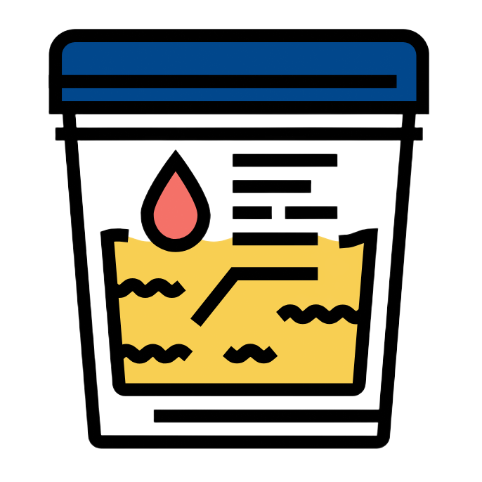 A medical urine sample container with yellow liquid, a drop of red liquid, and measurement lines.