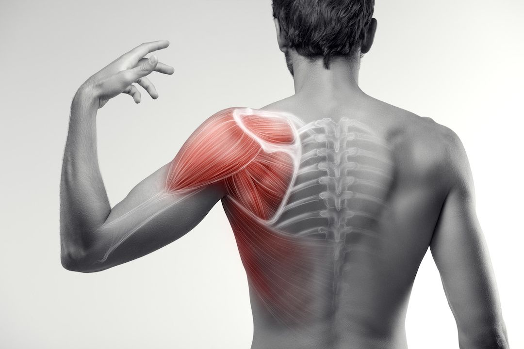 Back Pain Doctor