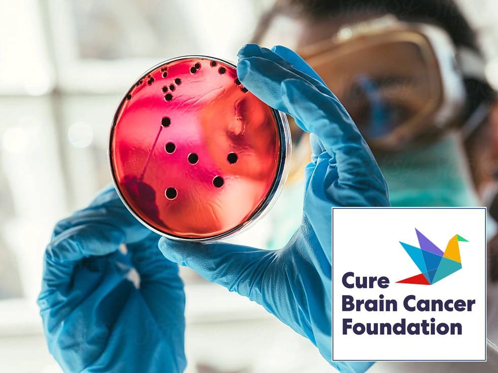 Cure Brain Cancer Foundation A person is holding a petri dish with a logo for the cure brain cancer foundation