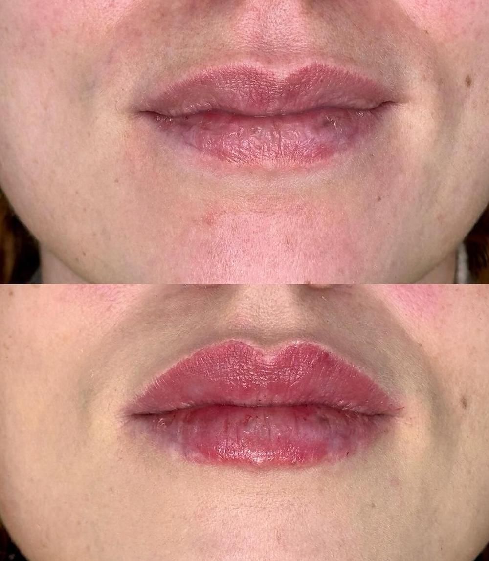 Medicina estetica a Balduina - Roma - Studio Stefania Lanzuolo