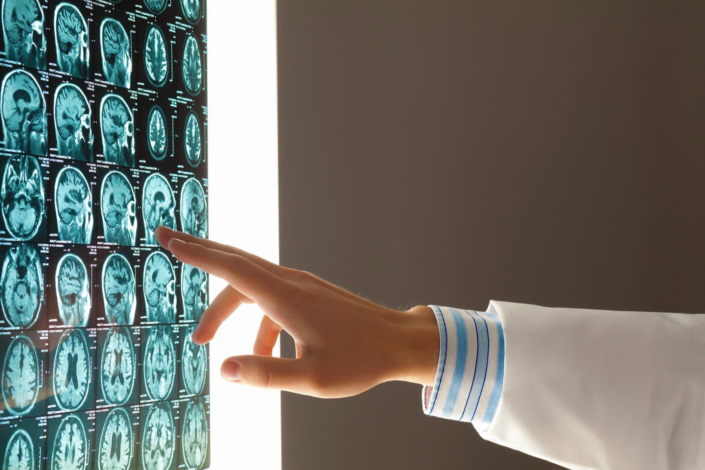 Una persona sta indicando una radiografia del cervello