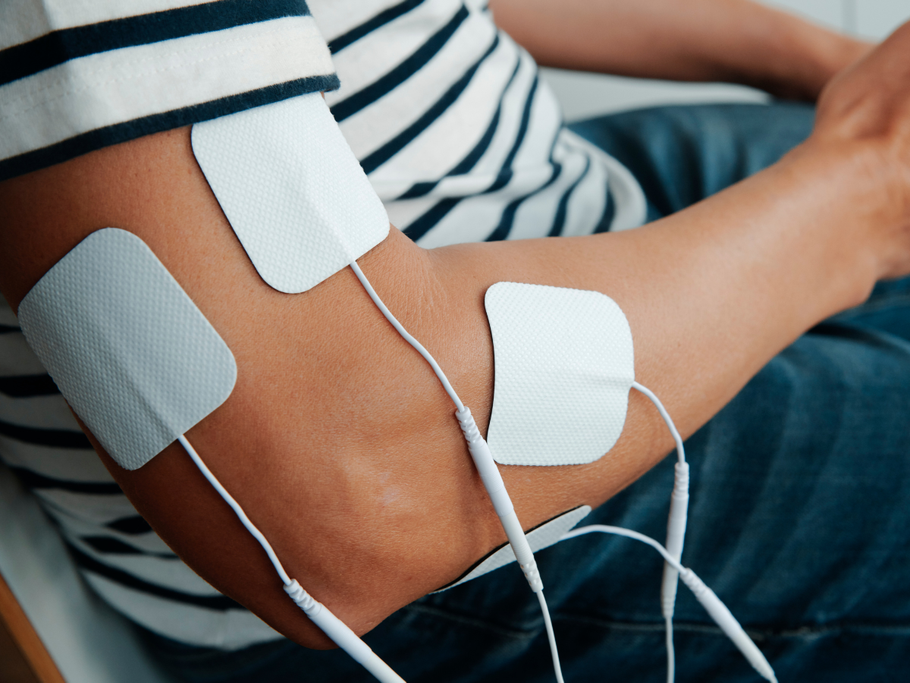 A person wearing a striped shirt has three white TENS unit electrode pads attached to their arm for pain relief therapy.
