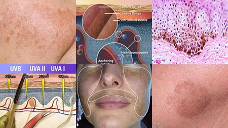 A collage of pictures of a woman 's face and skin