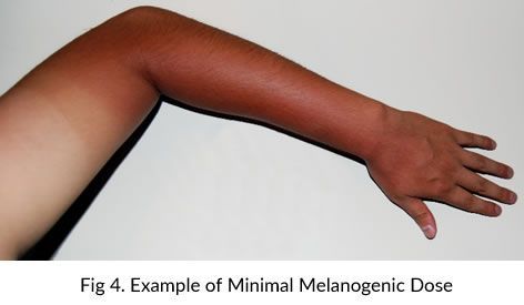 A person 's arm is shown with the words 