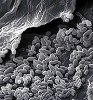 A black and white photo of bacteria under a microscope.