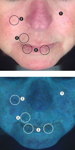 A close up of a woman 's face with circles on it.