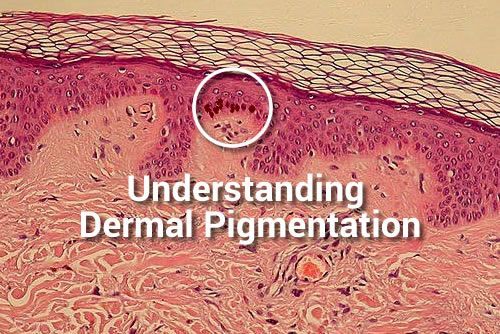 A close up of a piece of skin with the words `` understanding dermal pigmentation '' written on it.