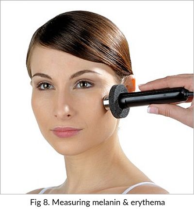 A woman is measuring melanin and erythema on her face