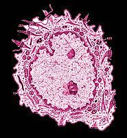 A picture of a cell under a microscope on a black background.