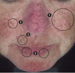 A close up of a person 's face with circles around it.
