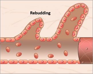 graphic of rebudding