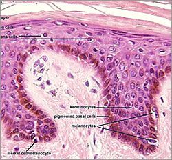 A picture of a tissue under a microscope with labels on it.