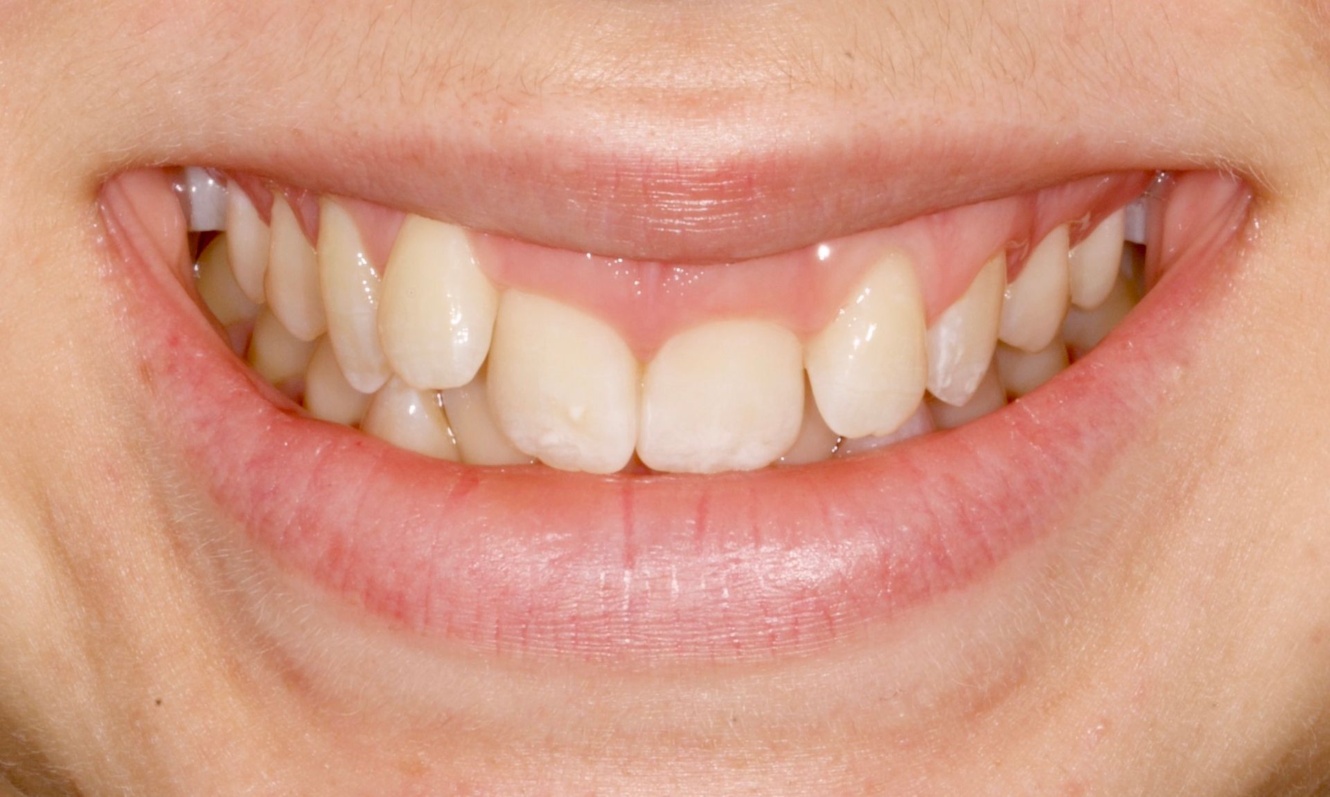Close-up of a smiling mouth showing white teeth and pink lips
