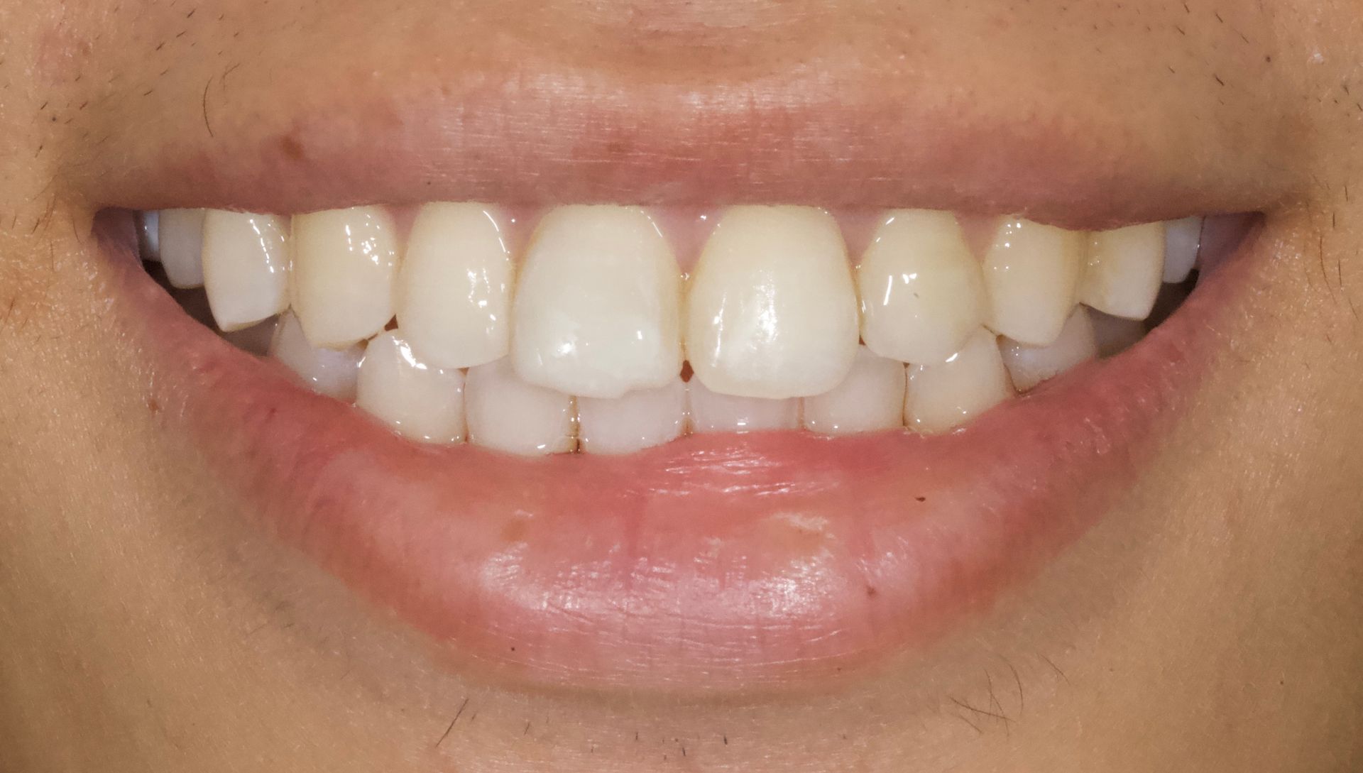 Close-up of a smiling mouth with white teeth and pink lips