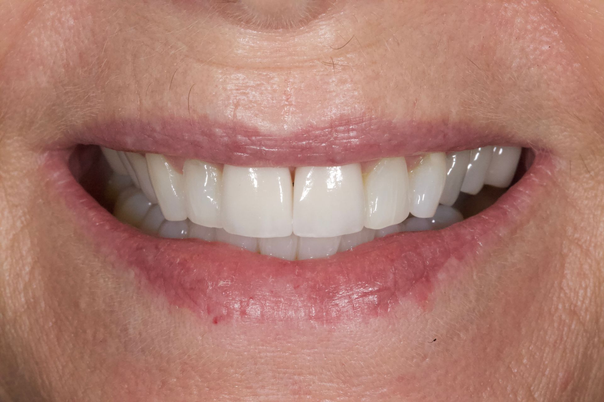 Close-up of a smiling mouth showing white teeth and pink lips