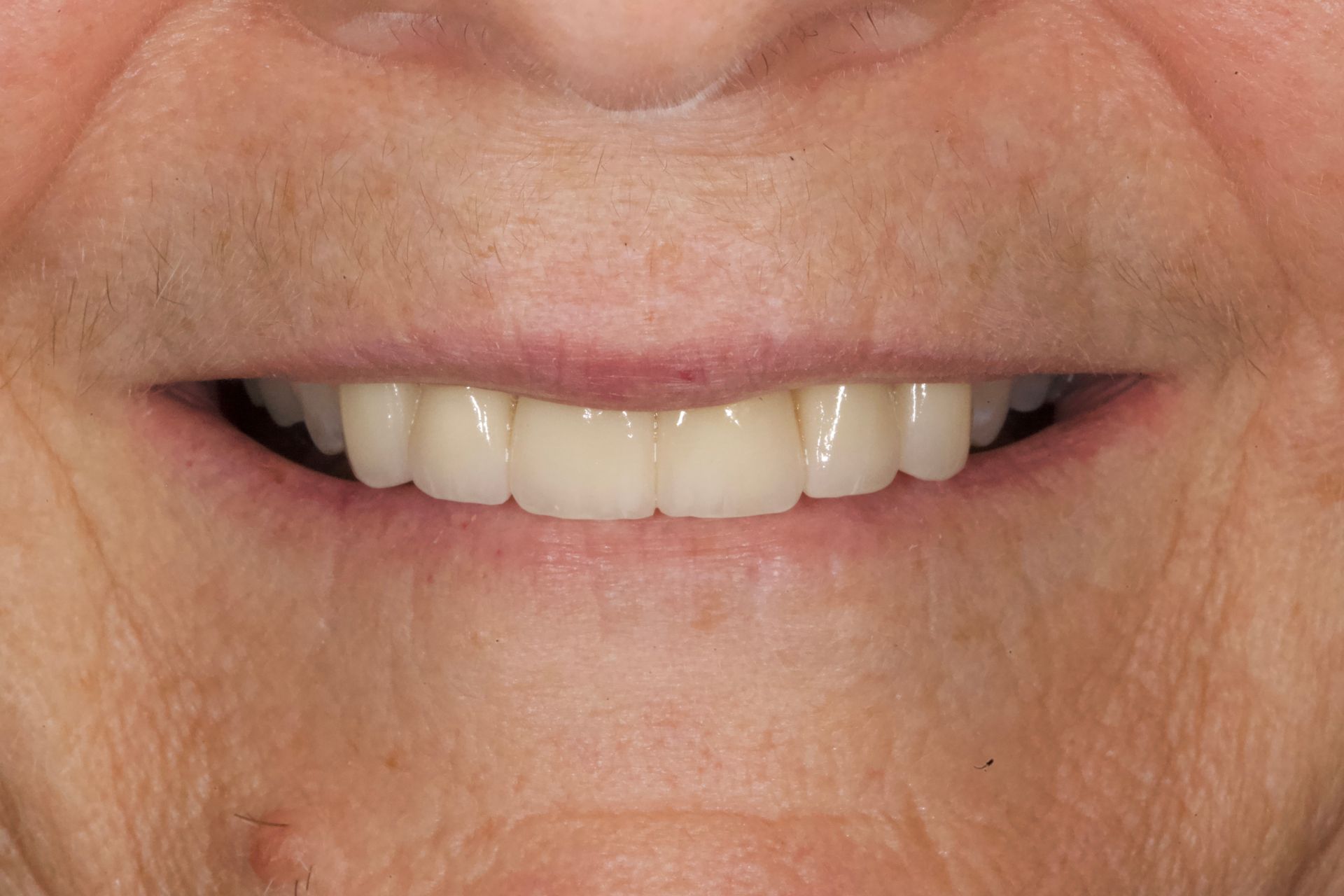 Close-up of a smiling mouth showing teeth and lips