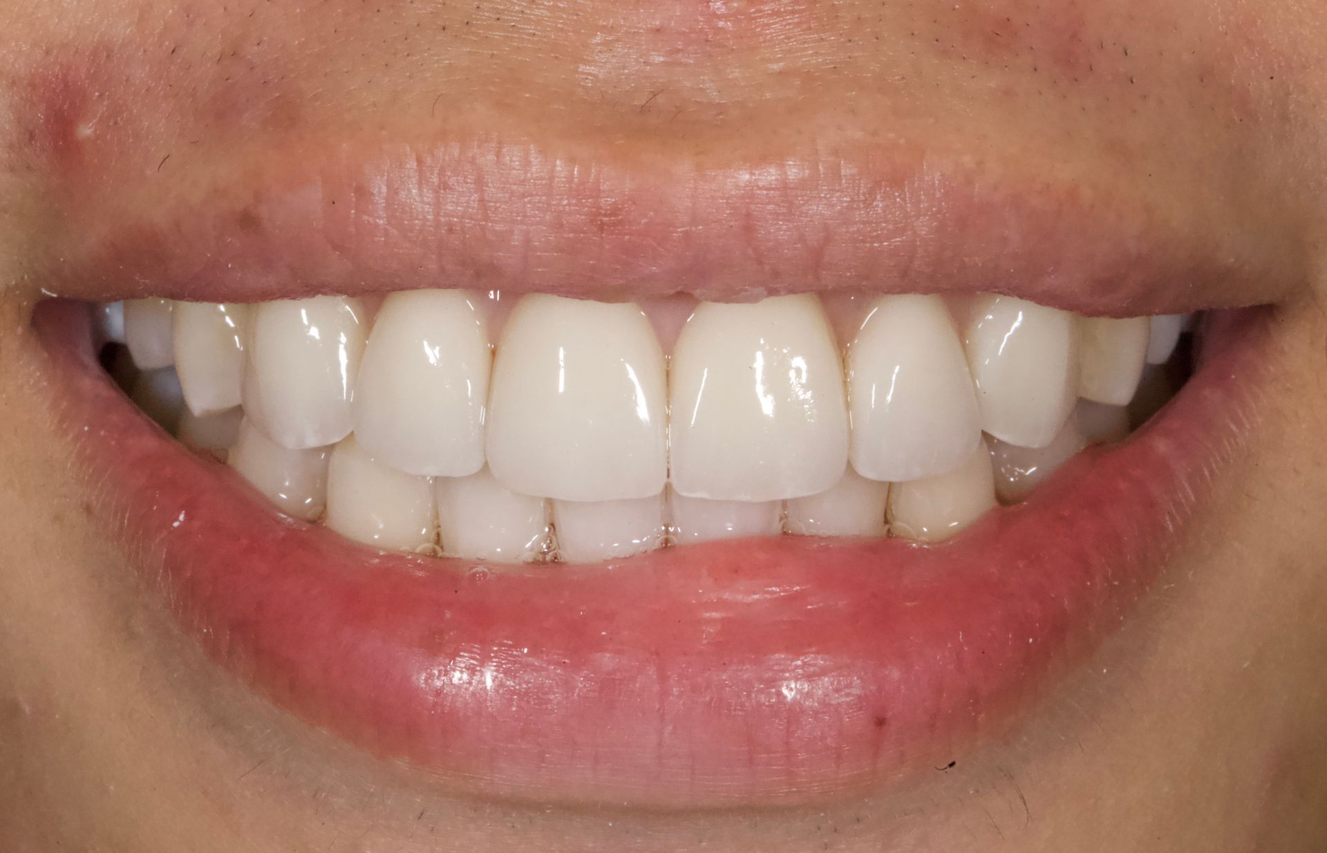 Close-up of a smiling mouth with white teeth and pink lips