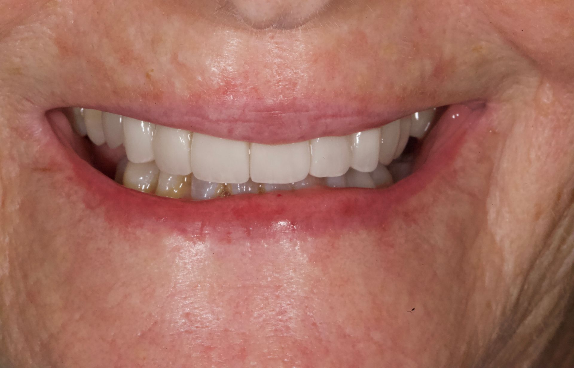 Close-up of a smiling mouth showing teeth and lips