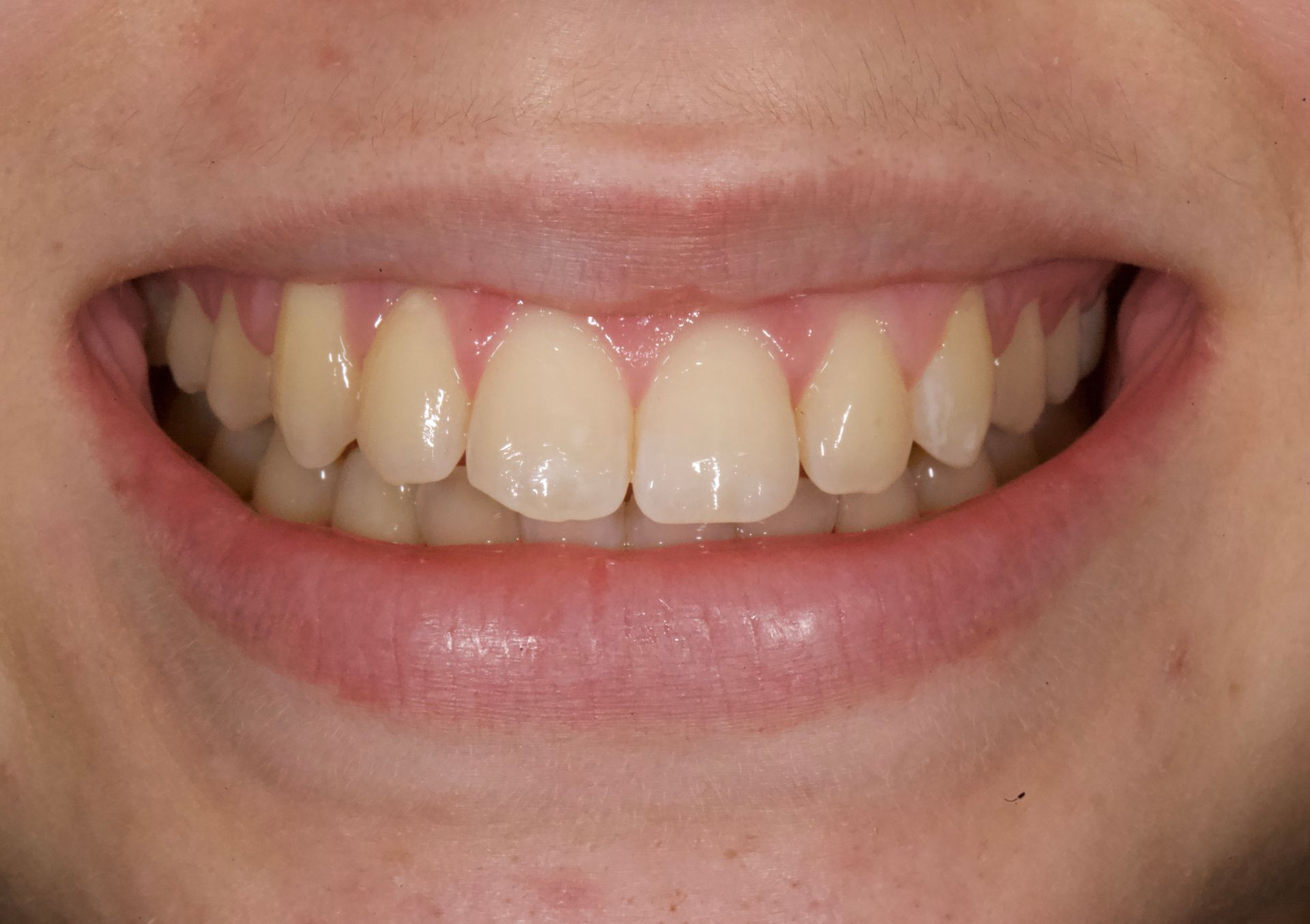 Close-up of a smiling mouth showing teeth and lips