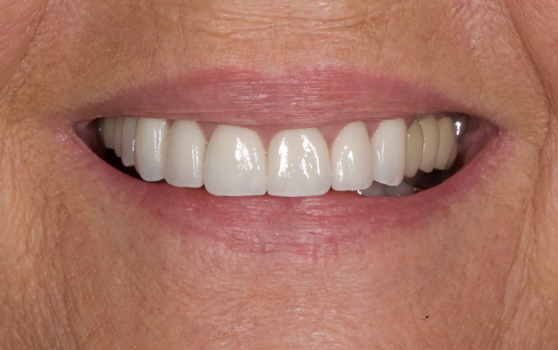 Close-up of a smiling mouth with bright white teeth and pink lips