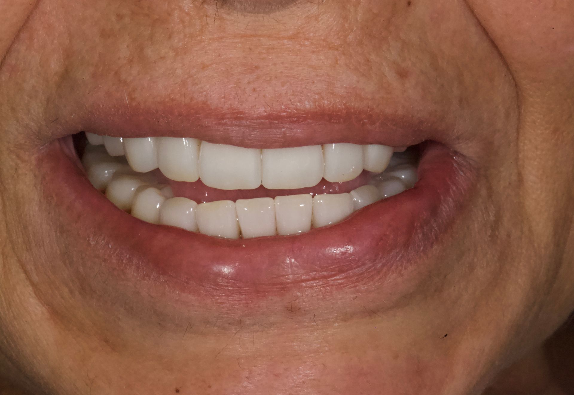 Close-up of a smiling mouth showing white teeth and pink lips