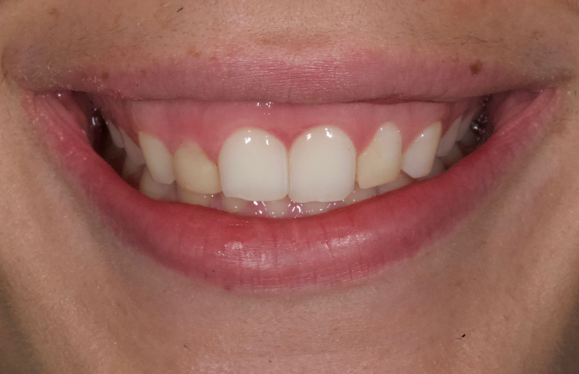 Close-up of a smiling mouth with teeth visible and pink lips
