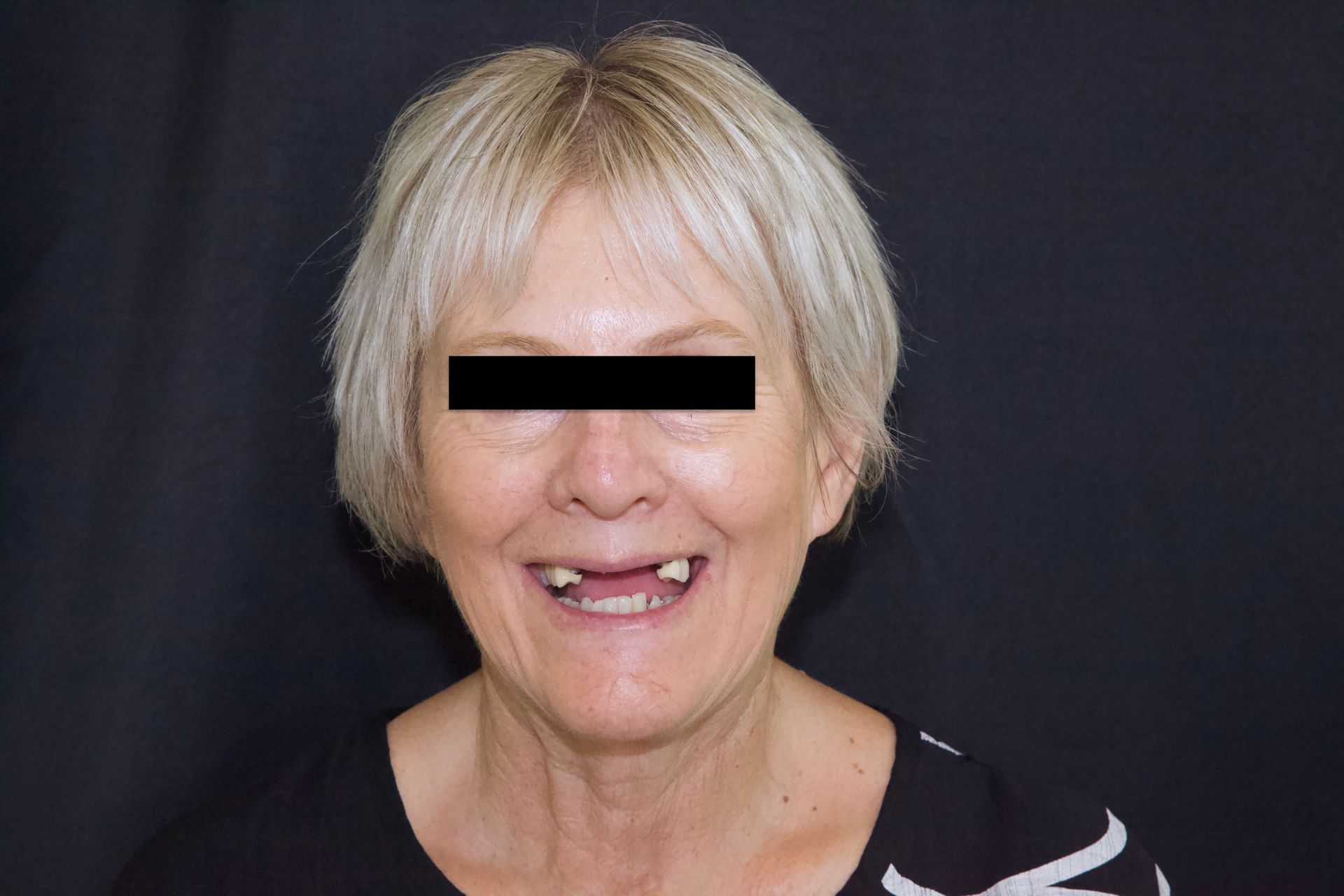 Smiling person with short blond hair against a dark background, black bar over eyes