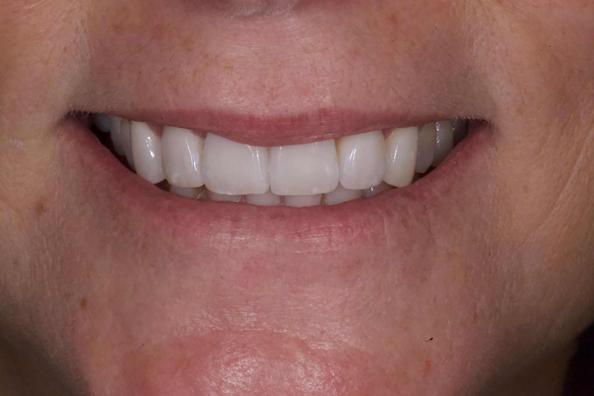 Close-up of a smiling mouth with white teeth and pink lips