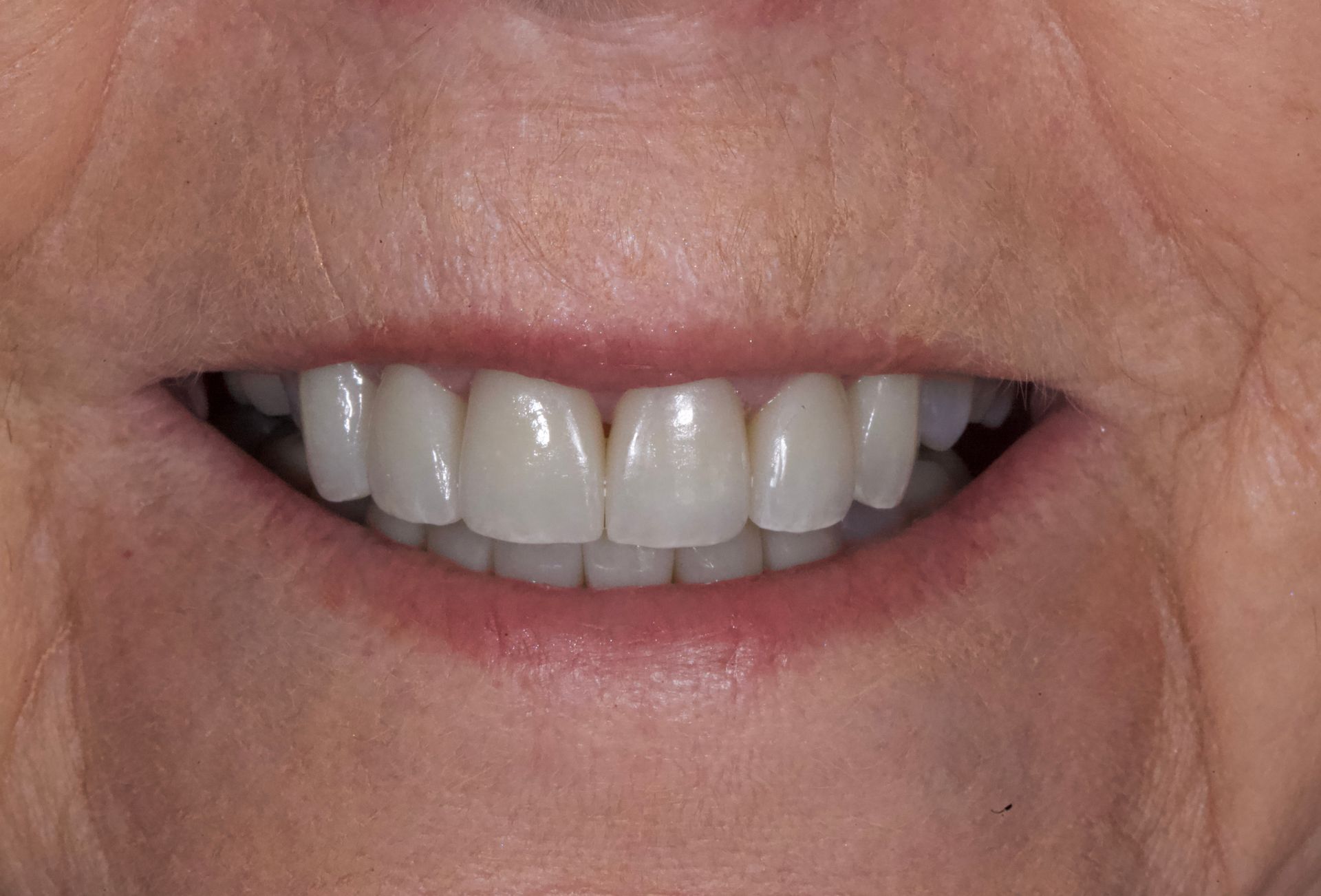 Close-up of a smiling mouth with white teeth and pink lips