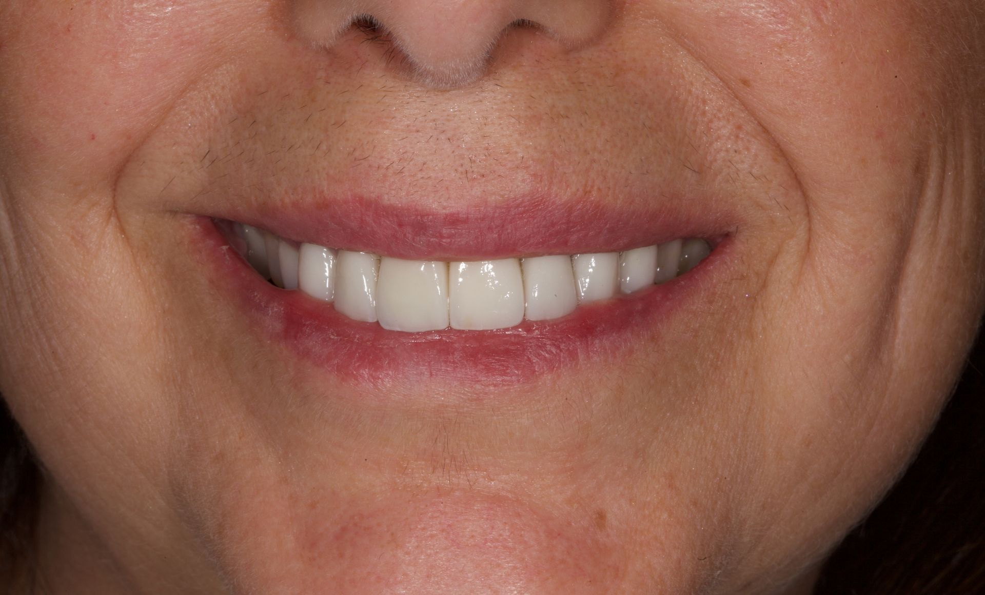 Close-up of a smiling mouth with white teeth and pink lips