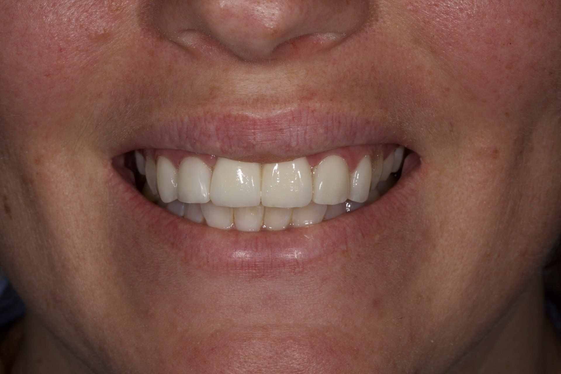 Close-up of a smiling mouth with white teeth and pink lips