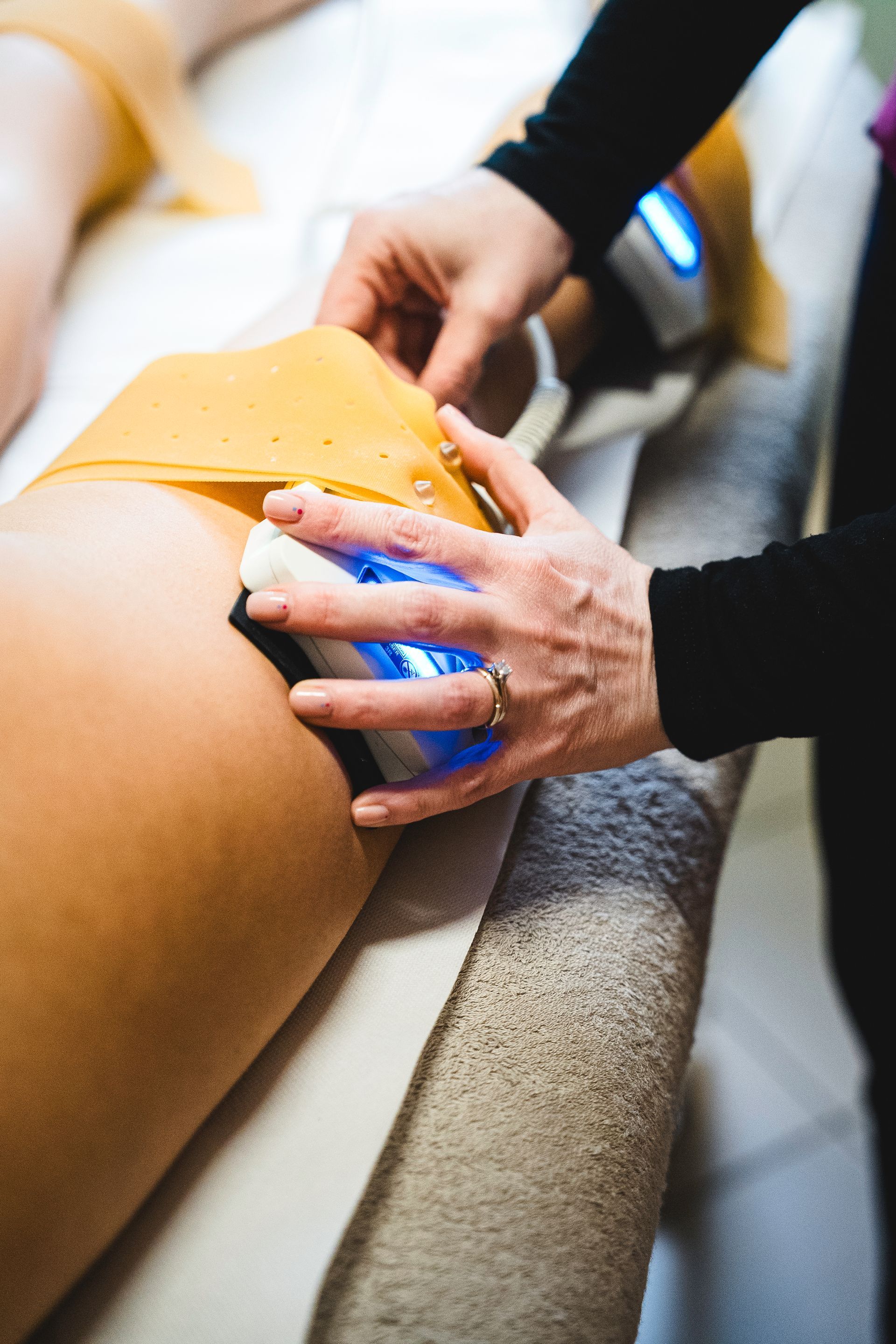 Un operatore sanitario utilizza un applicatore di crioterapia a luce blu sulla coscia di una paziente durante una procedura estetica di riduzione del grasso.