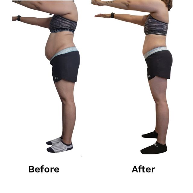 A before and after picture of a woman 's belly