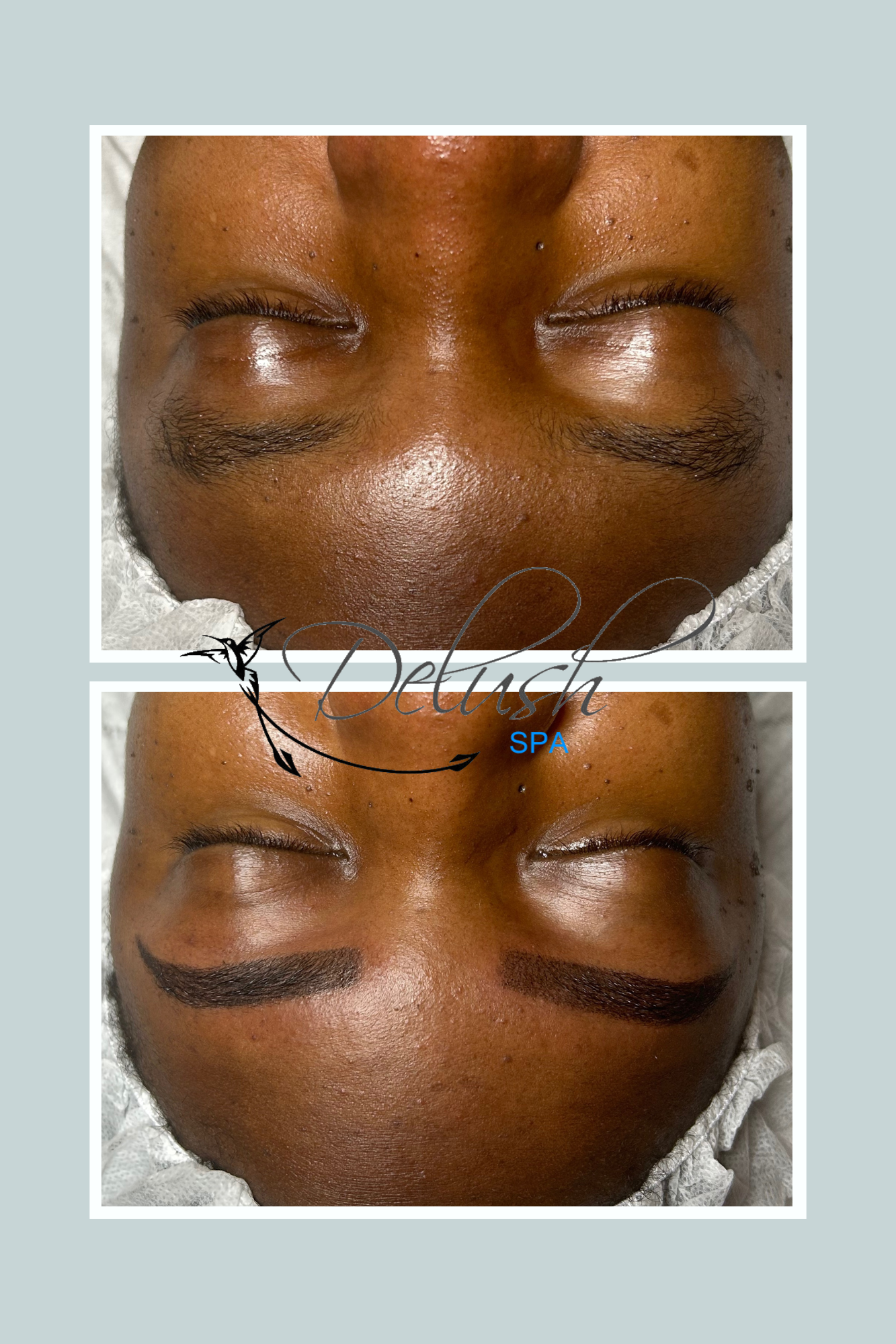 Close-up before-and-after of closed eyes with eyebrow and eyelid cosmetic treatment markings on the forehead