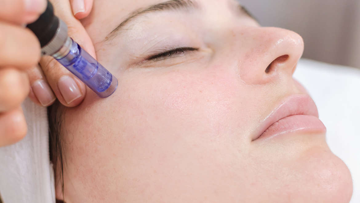 Facial skin treatment with a blue-handled device on a woman's cheek, eyes closed