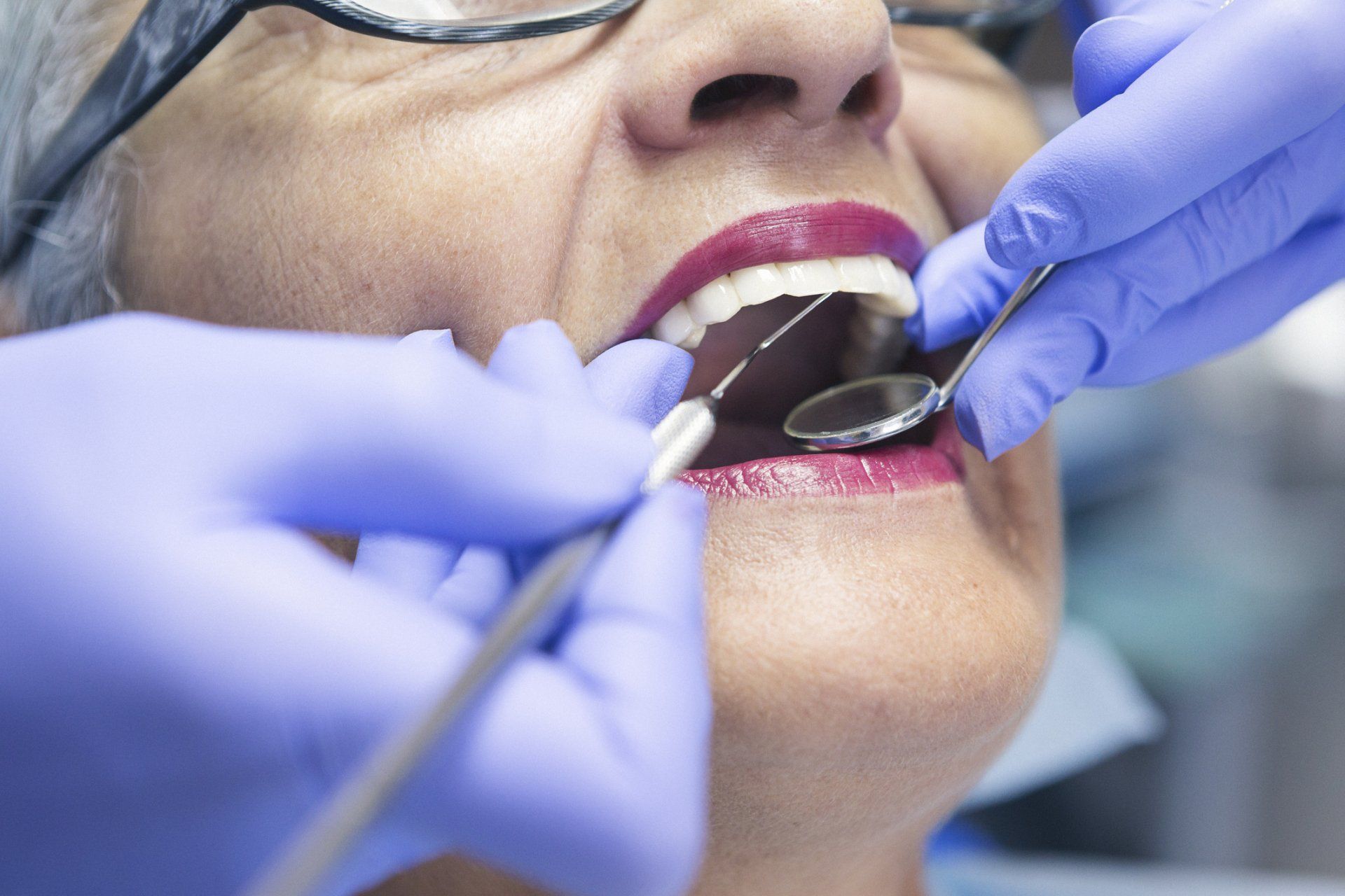 Senior Female Teeth — Wagga Wagga, NSW — Wagga Denture Clinic