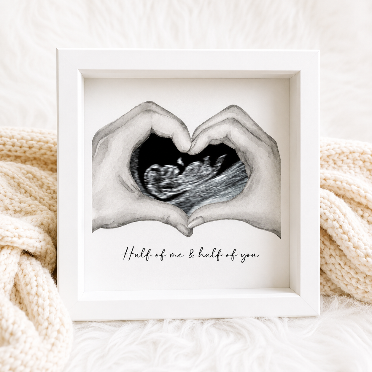 Half of Me, Half of You Scan Photo Box Frame